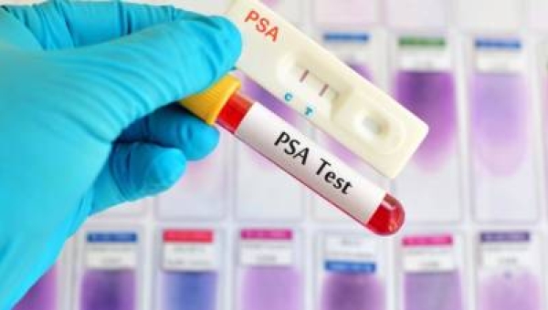 Il tumore alla prostata